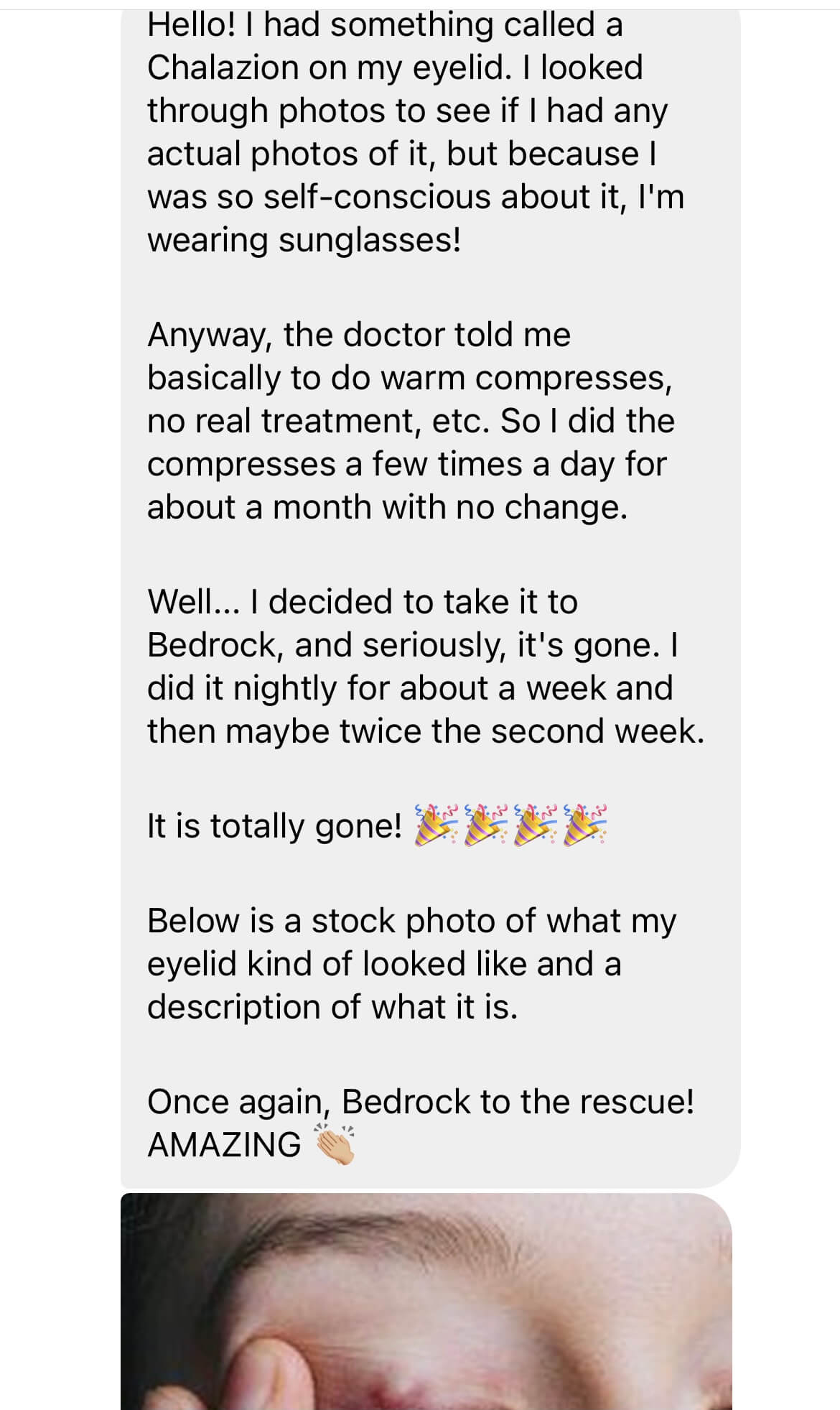 Bedrock Balm | Calming Redness Cream