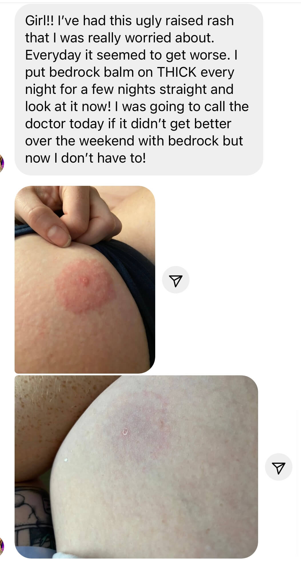 calming down cream bedrock balm anti redness skincare zinc oxide skincare